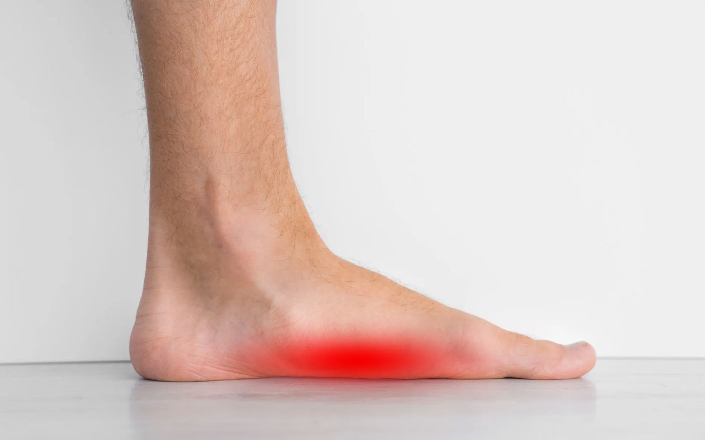 Flat Feet
