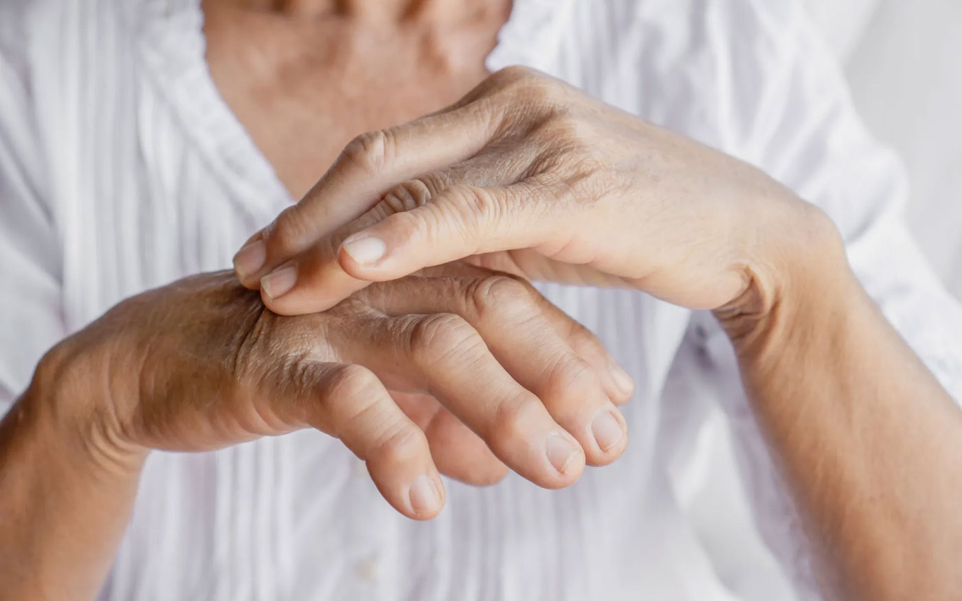 Gout Arizona Arthritis & Rheumatology Associates, P.C.